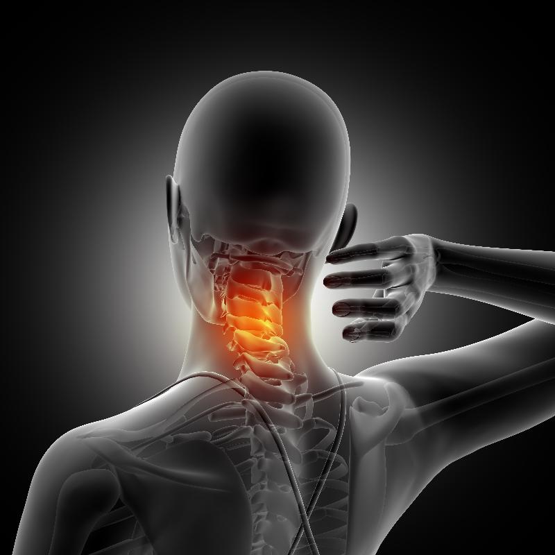 Pinched Neck Nerve or Stenosis pain