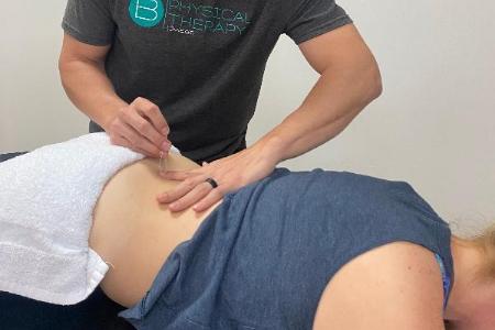 Dry needling for lower back pain